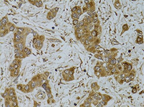 Immunohistochemistry - TNFSF13 antibody (144-01237)