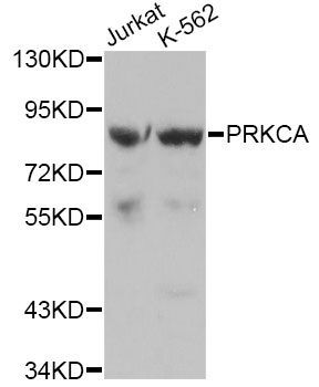 Western blot - PRKCA Polyclonal Antibody (144-00267)