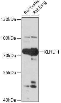 Western blot