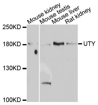 Western blot - UTY antibody (144-08563)