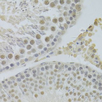Immunohistochemistry - HDGF Antibody (144-05347)