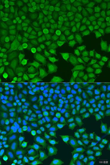 Immunofluorescence - BCKDK antibody (144-08184)