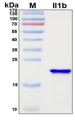 SDS-PAGE Image