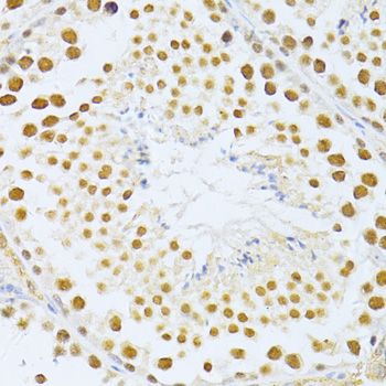 Immunohistochemistry - SIRT1 Polyclonal Antibody (144-011267)
