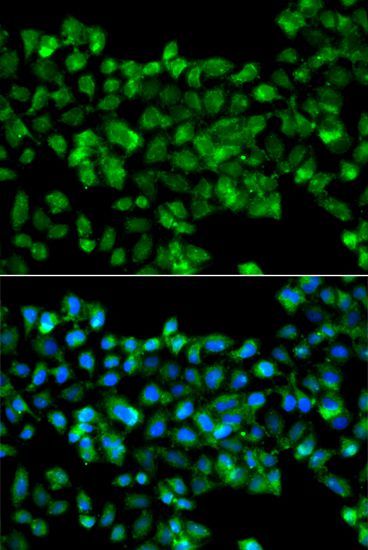 Immunofluorescence - CBR3 antibody (144-07545)