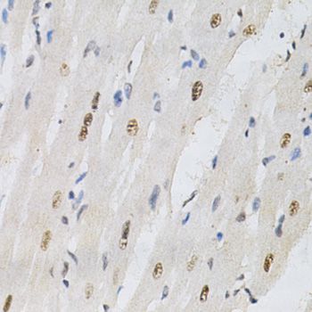 Immunohistochemistry - KPNA4 Antibody (144-02026)
