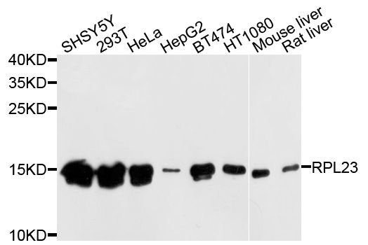 Western blot - RPL23 Polyclonal Antibody (144-04292)