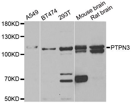 Western blot - PTPN3 antibody (144-06400)