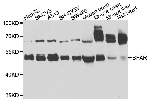 Western blot - BFAR Polyclonal Antibody (144-08308)