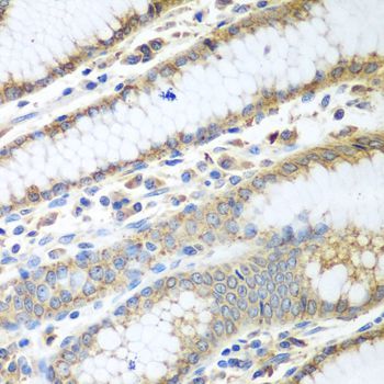 Immunohistochemistry - PDIA3 Polyclonal Antibody (144-01085)