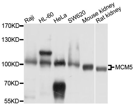 Western blot - MCM5 antibody (144-013514)