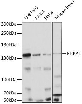 Western blot