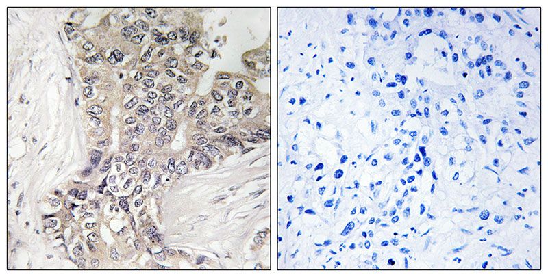 IHC