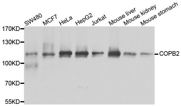 Western blot - COPB2 Polyclonal Antibody (144-07036)