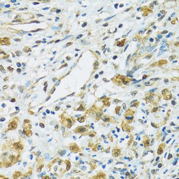Immunohistochemistry - RPS7 Polyclonal Antibody (144-06731)