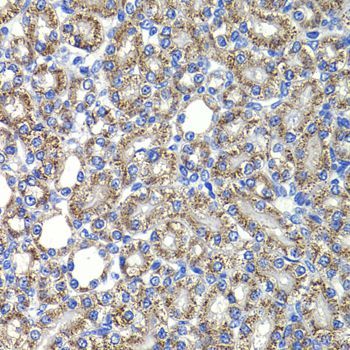 Immunohistochemistry - COPS2 Polyclonal Antibody (144-07037)