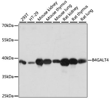 Western blot - B4GALT4 antibody (144-60752)