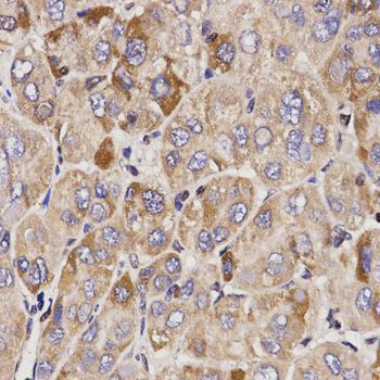 Immunohistochemistry - GAS2 antibody (144-01168)