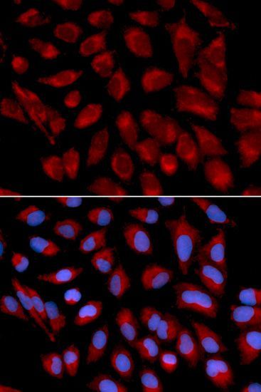 Immunohistochemistry - [KO Validated] AIFM1 Polyclonal Antibody (144-02568)