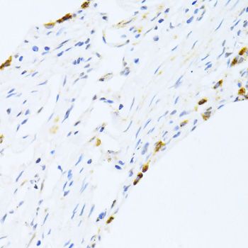 Immunohistochemistry - SFTPC antibody (144-01835)