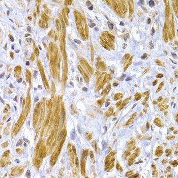 Immunohistochemistry - DSP Polyclonal Antibody (144-60272)