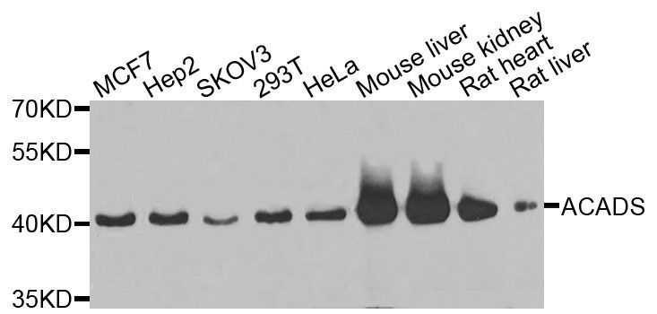 Western blot - ACADS Polyclonal Antibody (144-07230)