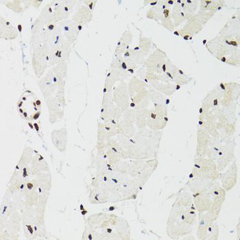 Immunohistochemistry - SFPQ Polyclonal Antibody (144-00958)