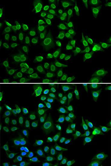 Immunofluorescence - LMNB2 Polyclonal Antibody (144-06483)