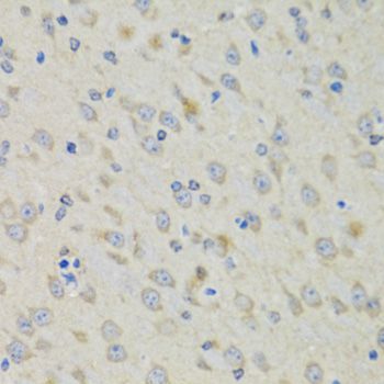 Immunohistochemistry - RAE1 antibody (144-06713)