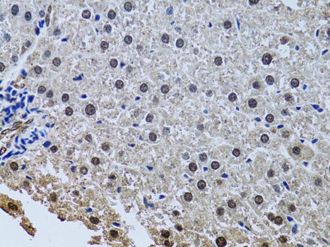 Immunohistochemistry - SIN3A antibody (144-60522)