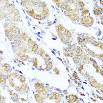 Immunohistochemistry - DARS2 antibody (144-07813)
