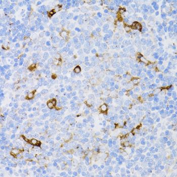 Immunohistochemistry - CD4 Polyclonal Antibody (144-60019)