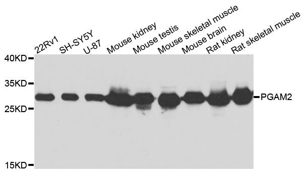 Western blot - PGAM2 antibody (144-07917)
