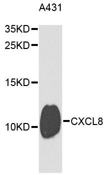 Western blot - IL8 Polyclonal Antibody (144-02541)