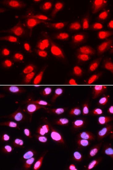 Immunofluorescence - U2AF2 Polyclonal Antibody (144-01936)