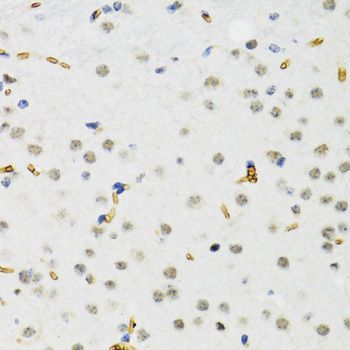 Immunohistochemistry - SETDB1 antibody (144-06145)