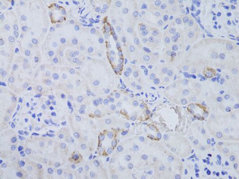 Immunohistochemistry - AQP3 Polyclonal Antibody (144-02838)
