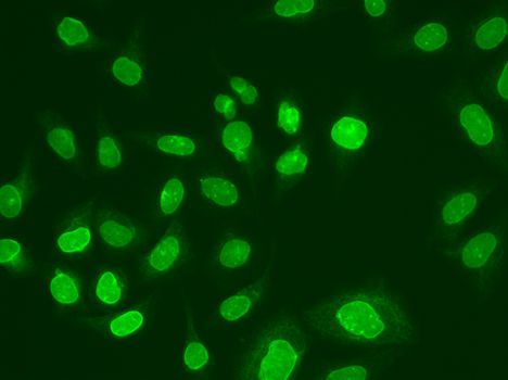 Immunofluorescence - UBE2V1 Polyclonal Antibody (144-06316)