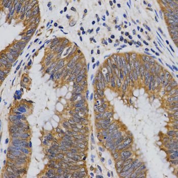 Immunohistochemistry - PIBF1 Antibody (144-03072)