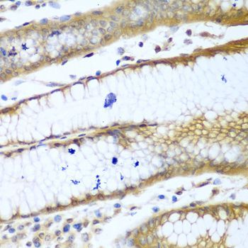Immunohistochemistry - [KO Validated] ROCK1 Polyclonal Antibody (144-01008)