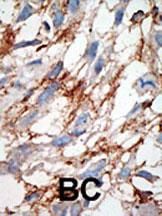 IHC-P
