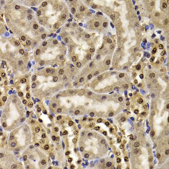 Immunohistochemistry - HIRIP3 antibody (144-07014)