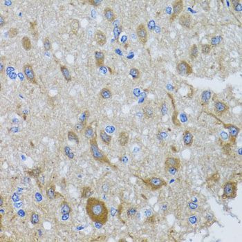 Immunohistochemistry - DYNC1I1 antibody (144-03833)