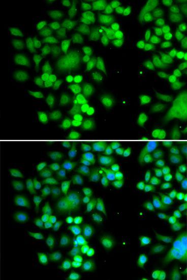 Immunofluorescence - PHYHD1 Polyclonal Antibody (144-07208)