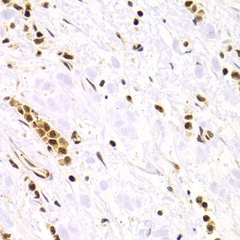 Immunohistochemistry - RAD50 Polyclonal Antibody (144-60013)