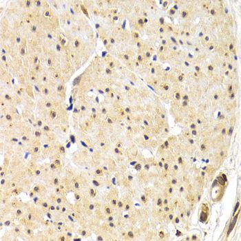 Immunohistochemistry - TERF1 Polyclonal Antibody (144-60007)
