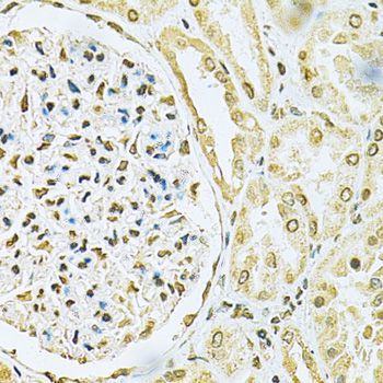 Immunohistochemistry - [KO Validated] HNRNPA2B1 Polyclonal Antibody (144-01162)