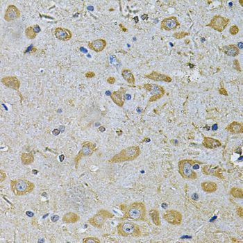 Immunohistochemistry - DAAM2 Antibody (144-07463)