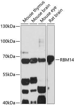 Western blot