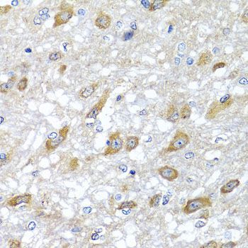 Immunohistochemistry - HSPA6 antibody (144-07688)